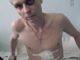 Избитый Сергей Иванов. Фото Комитета против пыток