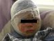 Ребенок, получивший ожоги после попытки коллектора поджечь дом (Ульяновск). Источник - bloknot.ru
